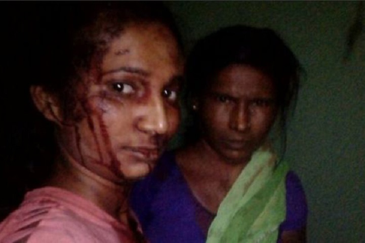 Rupali-বাঘের-সঙ্গে-লড়াই-After fighting with the tiger, bloody face in Selfi!