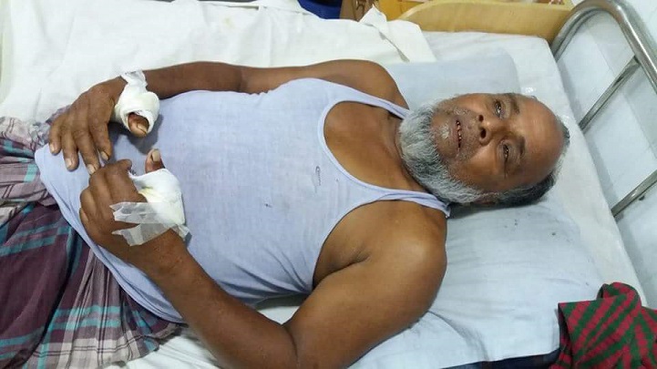 ইউপি-সদস্যকে-কুপিয়ে-আহত-Mymensingh chopped UP member injured