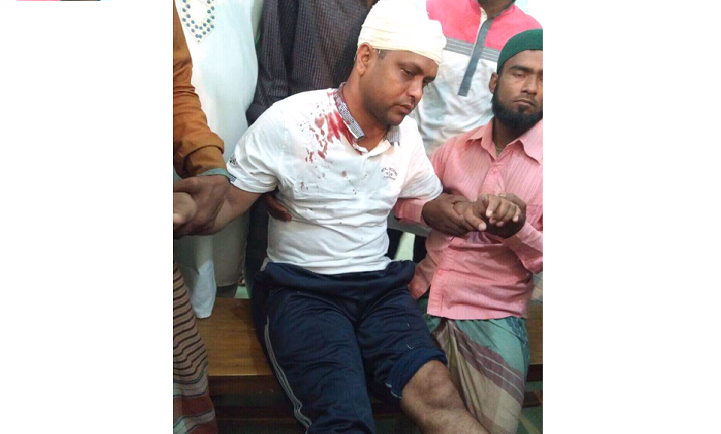 সন্ত্রাসী-হামলা-Terrorist attack on the mayor of Shariatpur Municipality