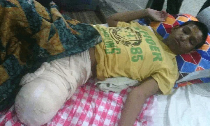 হাতুড়ে-চিকিৎসকের-খপ্পরে-Habibullah lost his foot after being hit by a doctor in Nandail